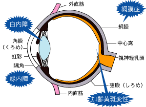 眼の病気はここで起こります