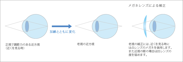 メガネレンズによる補正